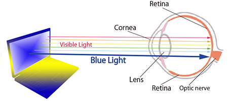 Retinal Damage